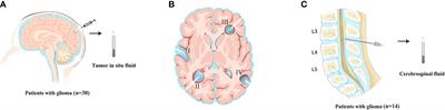 Tumor DNA From Tumor In Situ Fluid Reveals Mutation Landscape of Minimal Residual Disease After Glioma Surgery and Risk of Early Recurrence